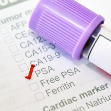 Prostate cancer PSA test