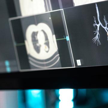 image of a screen showing lung xrays