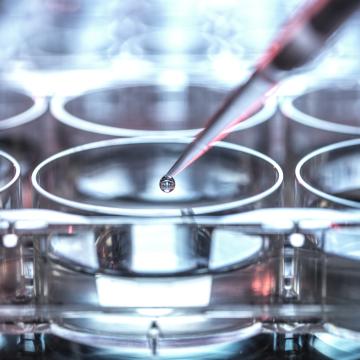 lab samples