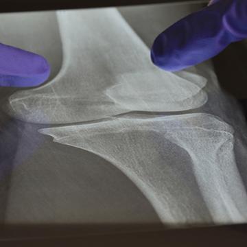 orthopedic surgery