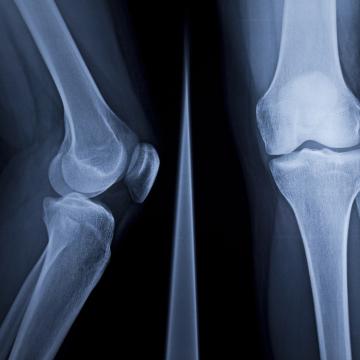 leg xray
