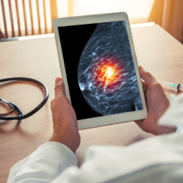 City of Hope treats first patient in leading-edge clinical trial for breast cancer