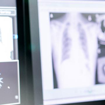 Peter Baik, M.D., thoracic surgeon at City of Hope® Cancer Center Phoenix in front of MRI images