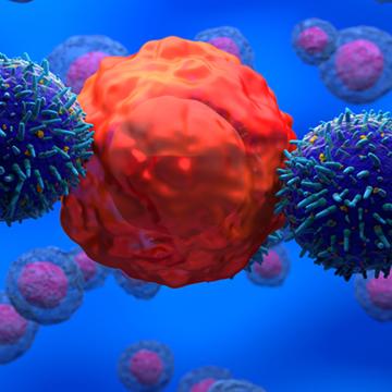 Blood cancer cells as shown through a microscope