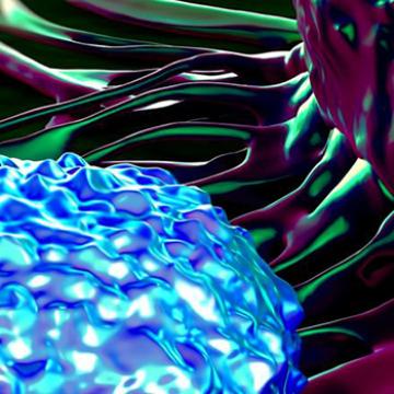 How to build a successful outpatient CAR T cell therapy program 