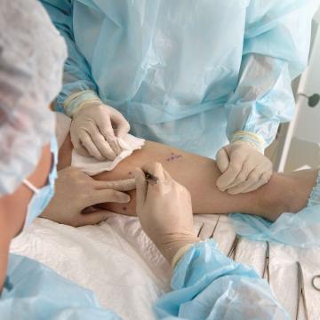 Lymphedema Surgery Blog Image