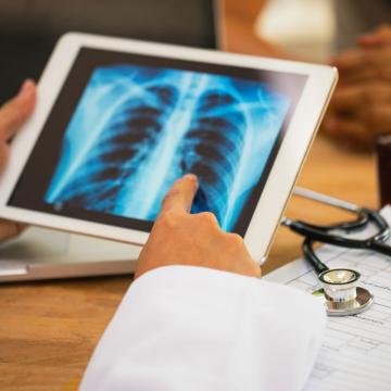 Physician reviewing a lung x-ray on an iPad