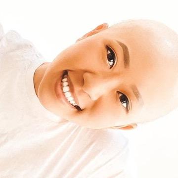 After cancer at 27
