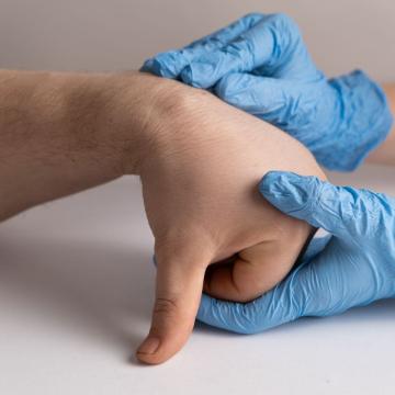 Healthcare professional checking patient's hand for cyst or tumor
