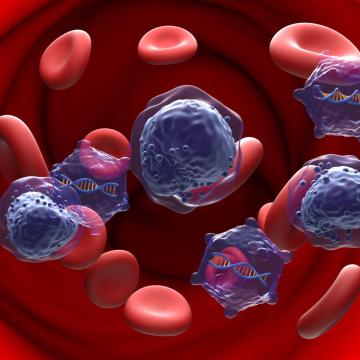 Close up image of leukemia cells