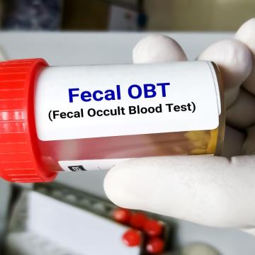 Close up image of technician holding a fecal occult blood test