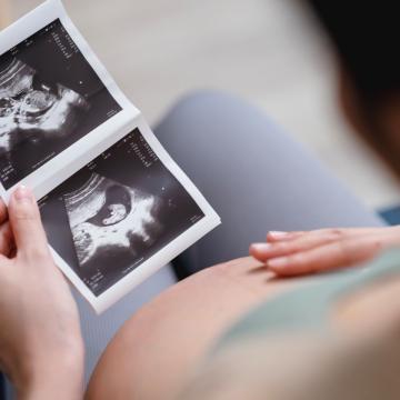 Pregnant woman touching her belly and looking at a sonogram image