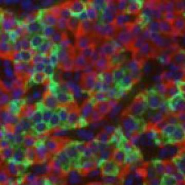 Islet Cells - small low res 300x140