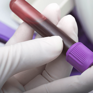 liquid_biopsy_blood_sample