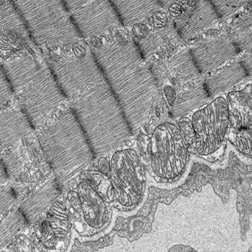 Electron Microscopy