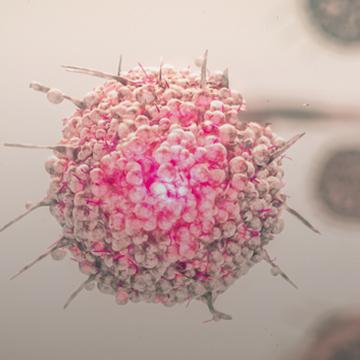 Neuroendocrine Tumor | City of Hope
