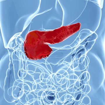 Purging pancreatic cancer with bacteria-based immunotherapy