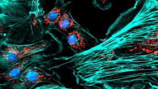 Mark LaBarge Lab Fibroblast banner