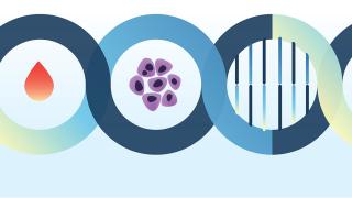 The Annual Diabetes and Cancer Interface Symposium: Connecting the Dots
