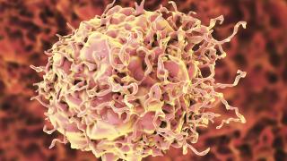 Red, orange and yellow colon cancer cell, computer illustration