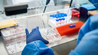 City of Hope 2015 - Dr. Salgia Lab