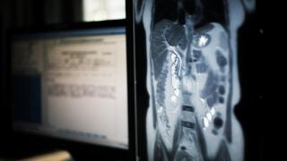 abdomen MRI image showing on medical monitor