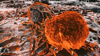 3d rendered image, abstract enhanced scanning electron micrograph (SEM) of cancer malignant cells.
