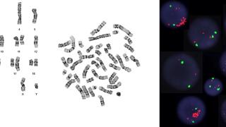 Cytogenetics Banner