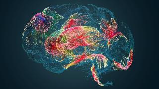 An artist's rendering of glioblastoma cells