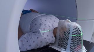 radiation therapy