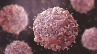 cancer cells