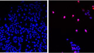 AOH1996 targets a cancerous variant of the protein  PCNA; programmed cell death