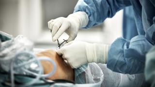 surgery stock photo