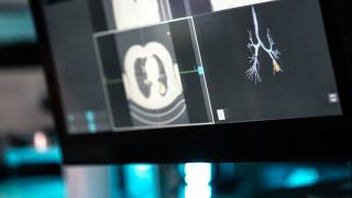 image of a screen showing lung xrays