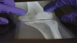 orthopedic surgery