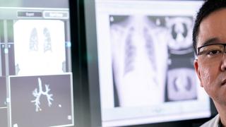 Peter Baik, M.D., thoracic surgeon at City of Hope® Cancer Center Phoenix in front of MRI images