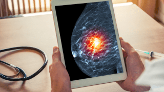 City of Hope treats first patient in leading-edge clinical trial for breast cancer
