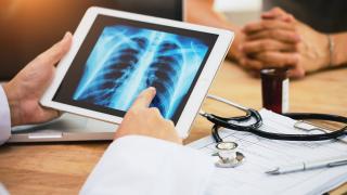 image of a chest x-ray being reviewed on a hand held viewer