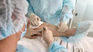 Lymphedema Surgery Blog Image