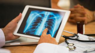 Physician reviewing a lung x-ray on an iPad