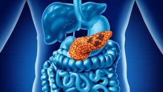 Image of internal human organs, highlighting a cancerous pancreas 