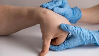 Healthcare professional checking patient's hand for cyst or tumor