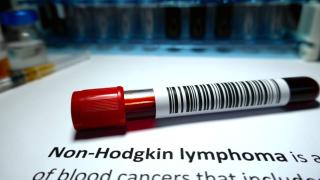 Vial of blood with non-Hodgkin lymphoma written below it
