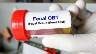 Close up image of technician holding a fecal occult blood test