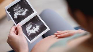 Pregnant woman touching her belly and looking at a sonogram image
