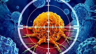 3D rendering of glowing cancer cell