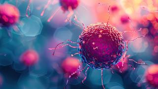 Prostate cancer cells