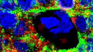 Islets sHLA, Farooq Syed Lab | City of Hope