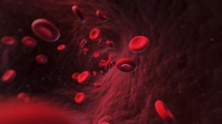 cord blood transplant