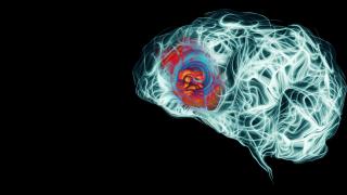 Brain Cancer Glioblastoma (GBM) Tumor | City of Hope